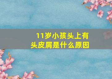 11岁小孩头上有头皮屑是什么原因