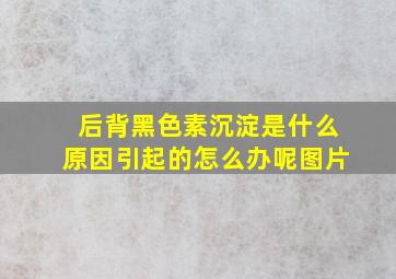 后背黑色素沉淀是什么原因引起的怎么办呢图片