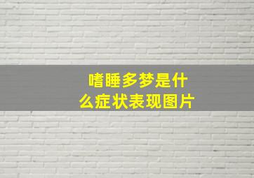 嗜睡多梦是什么症状表现图片