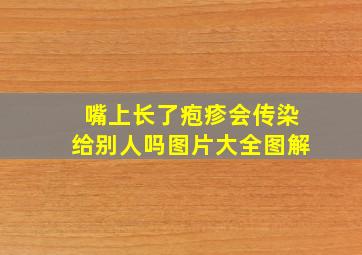 嘴上长了疱疹会传染给别人吗图片大全图解