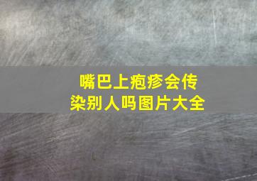 嘴巴上疱疹会传染别人吗图片大全