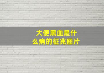 大便黑血是什么病的征兆图片