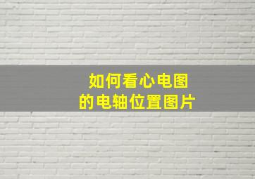 如何看心电图的电轴位置图片