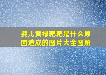 婴儿黄绿粑粑是什么原因造成的图片大全图解