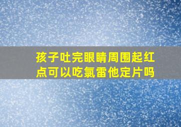 孩子吐完眼睛周围起红点可以吃氯雷他定片吗