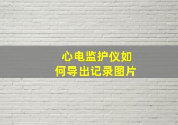 心电监护仪如何导出记录图片