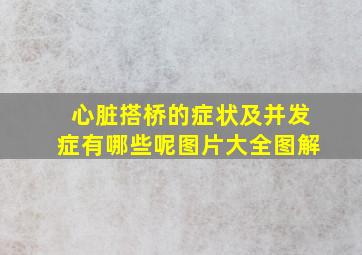 心脏搭桥的症状及并发症有哪些呢图片大全图解