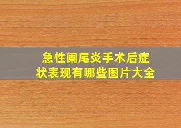 急性阑尾炎手术后症状表现有哪些图片大全