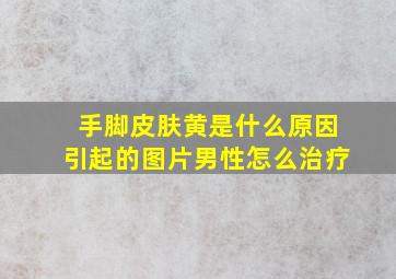 手脚皮肤黄是什么原因引起的图片男性怎么治疗