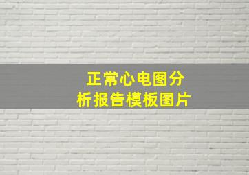 正常心电图分析报告模板图片