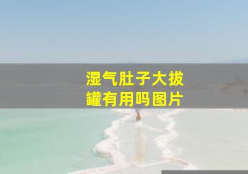 湿气肚子大拔罐有用吗图片