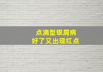 点滴型银屑病好了又出现红点