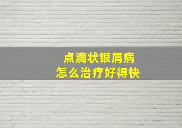 点滴状银屑病怎么治疗好得快