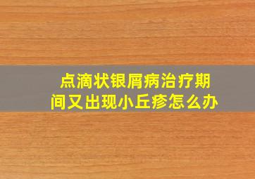 点滴状银屑病治疗期间又出现小丘疹怎么办