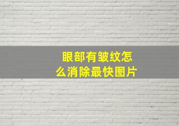 眼部有皱纹怎么消除最快图片