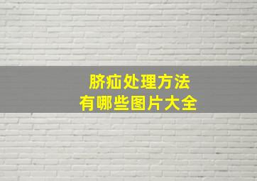 脐疝处理方法有哪些图片大全