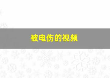 被电伤的视频