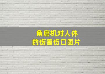 角磨机对人体的伤害伤口图片